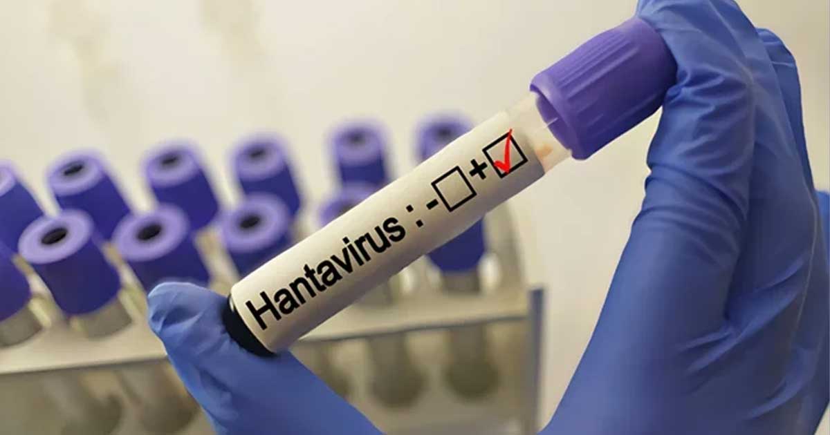stare de alerta la nivel mondial oms se confrunta cu doua crize sanitare iar hantavirusul provoaca fiori 997604 Spitalul Clinic Județean de Urgență Arad, caz confirmat hantavirus tânăr 25 ani, mai 2026